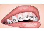 Odontoiatra con specializzazione in ortodonzia