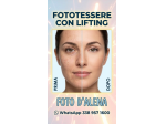 Fototessere con lifting del viso