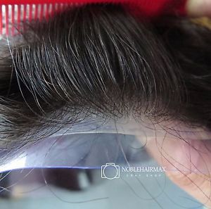 INFOLTIMENTO CAPELLI - PROTESI CAPILLARE - METODO HOLLYWOOD - Foto 10