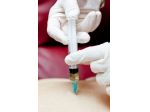 Iniezioni-medicazioni
