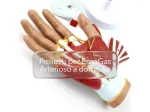 Prelievo Emogas  arterioso  a domicilio, a Catania