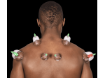Massaggi - benessere Roma - Terapia combinata manuale Tel:3917392017
