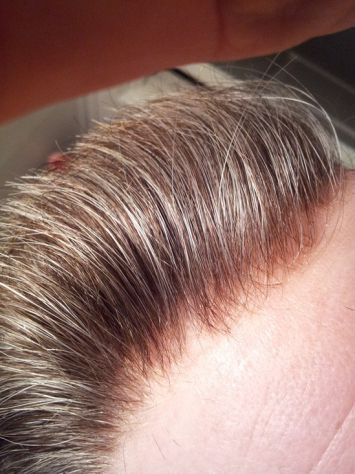 INFOLTIMENTO CAPELLI VERI - LA SOLUZIONE DEFINITIVA ALLA CALVIZIE! - Foto 10