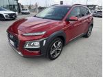 Hyundai Kona 1.6 CRDi 115cv Connect