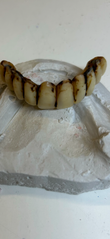 Riparazioni1ora ProtesiDentali Dentiere Odontotecnico Festivi Domicilio Bologna - Foto 2