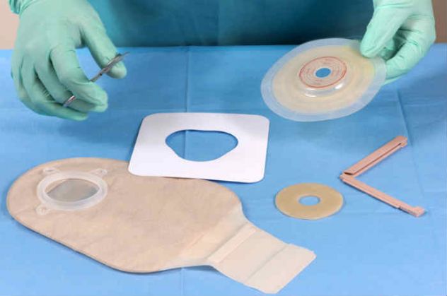 MEDICAZIONE /GESTIONE UROSTOMIA -ILEOSTOMIA A DOMICILIO A CATANIA - Foto 4