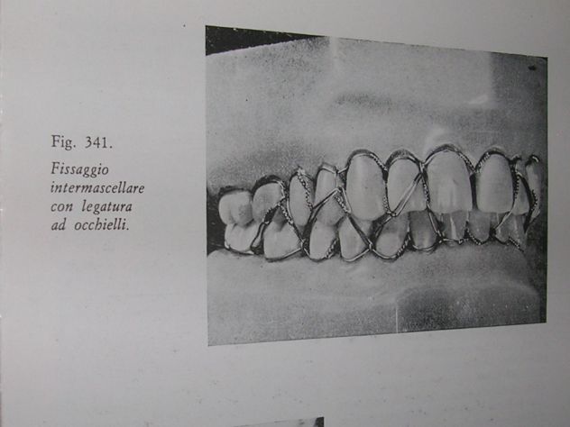 ESERCIZI PRATICI DI MECCANICA DENTALE - Foto 10