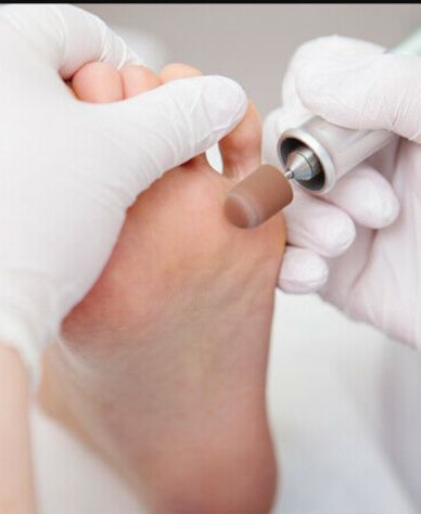 Pedicure igienico e curativo a domicilio Bologna Tel:3472718049