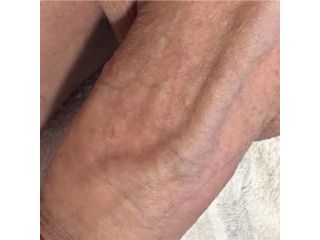 Massaggi - benessere Cinisello Balsamo - DEPILAZIONE UOMO.