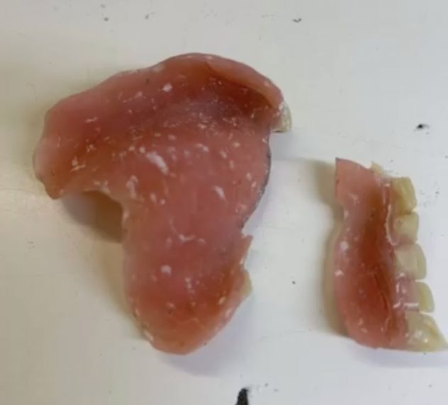 Riparazioni1ora ProtesiDentali Dentiere Odontotecnico Festivi Domicilio Bologna - Foto 4