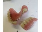 Riparazioni1ora ProtesiDentali Dentiere Odontotecnico Festivi Domicilio Bologna