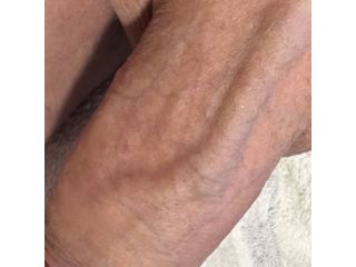 Massaggi - benessere Cinisello Balsamo - DEPILAZIONE UOMO Tel:3332298205