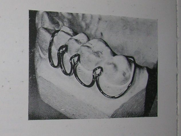 ESERCIZI PRATICI DI MECCANICA DENTALE - Foto 9