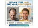 Ritrova i Tuoi Capelli e la Tua Fiducia | Eccellenza nel Trapianto