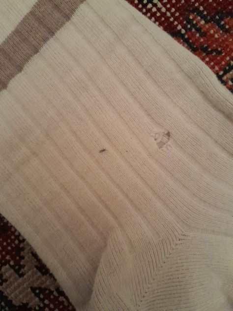 h&m calzino corto distressed - Foto 2