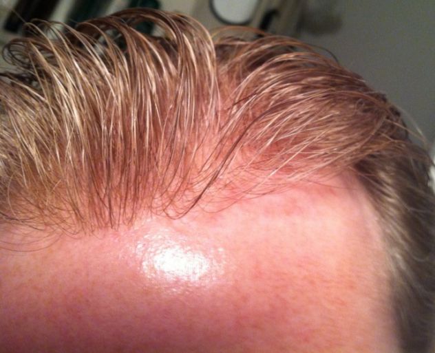INFOLTIMENTO CAPELLI VERI - LA SOLUZIONE DEFINITIVA ALLA CALVIZIE! - Foto 7