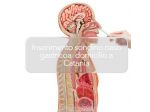 INSERIMENTO SONDINO NASO GASTRICO A DOMICILIO CATANIA