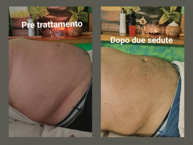 ELIMINARE IL GRASSO ADDOMINALE - Foto 2 Tel:3203129913