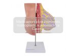 Medicazione seno post mastoplastica, a domicilio a Catania