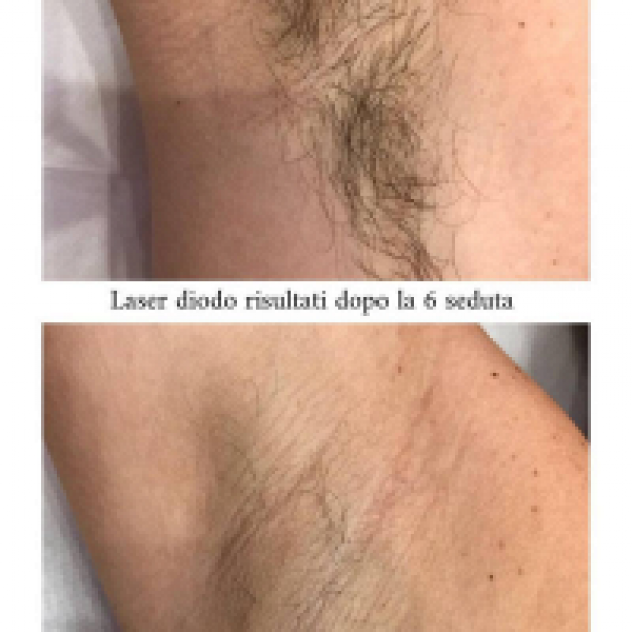 Per Te Estetica - Foto 4