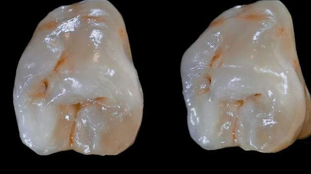 ODONTOTECNICO CERAMISTA MILANO E PROVINCIA - Foto 3