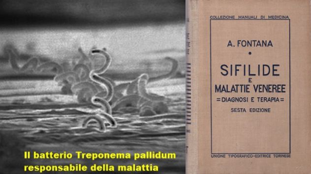 SIFILIDE E MALATTIE VENEREE, DIAGNOSI E TERAPIA, A. FONTANA, UTET 1942.