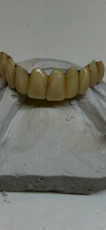 Riparazioni1ora ProtesiDentali Dentiere Odontotecnico Festivi Domicilio Bologna - Foto 3
