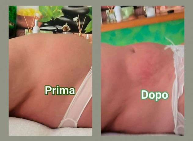 ELIMINARE IL GRASSO ADDOMINALE - Foto 3 Tel:3203129913