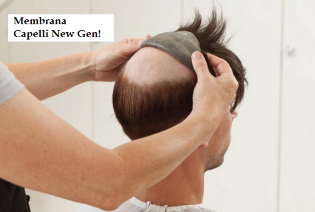 INFOLTIMENTO CAPELLI - PROTESI CAPILLARE - METODO HOLLYWOOD - Foto 4