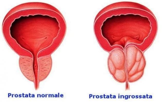 DISFUNZIONI alla PROSTATA, ERETTILI, EIACULAZIONE PRECOCE - Foto 2 Tel:3203129913