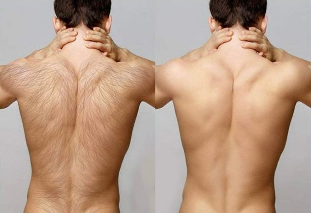 ESTETICA, MASSAGGI E DEPILAZIONE LUI & LEI - Foto 2