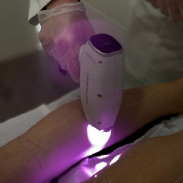 Alive Beauty - Hair Remove Laser Center - Foto 4