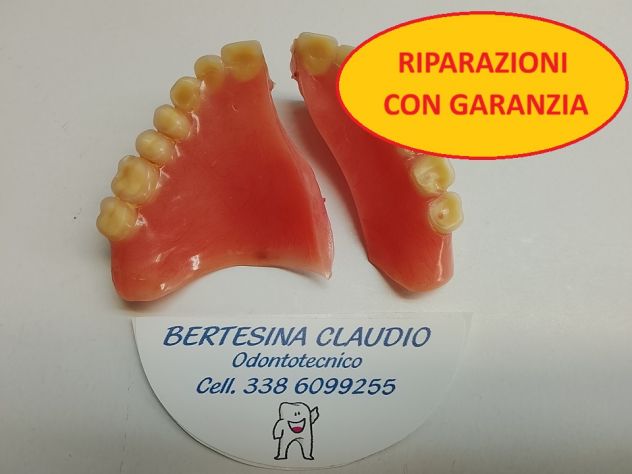 RIPARAZIONE PROTESI DENTALE 1 ORA - Foto 2