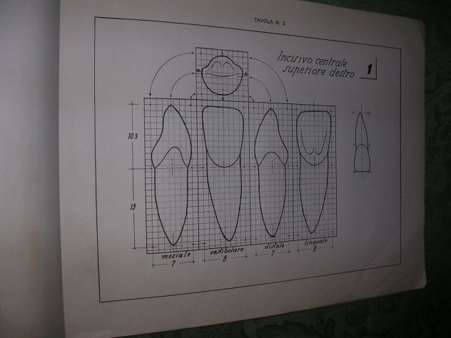 IL DISEGNO DEI DENTI - Foto 6