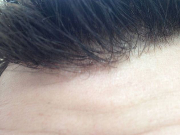 INFOLTIMENTO CAPELLI - PROTESI CAPILLARE - METODO HOLLYWOOD - Foto 9