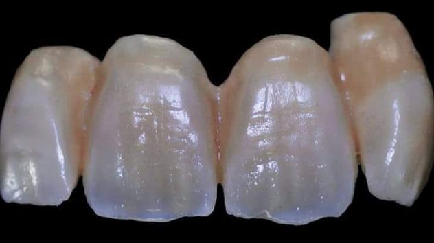 ODONTOTECNICO CERAMISTA MILANO E PROVINCIA