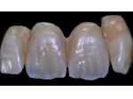 ODONTOTECNICO CERAMISTA MILANO E PROVINCIA