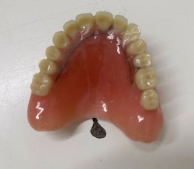 Riparazioni1ora ProtesiDentali Dentiere Odontotecnico Festivi Domicilio Bologna - Foto 5