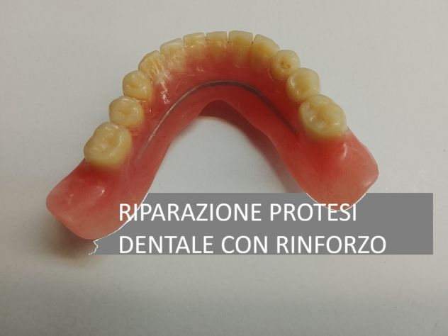 RIPARAZIONE PROTESI DENTALE 1 ORA - Foto 4